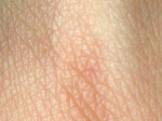 Human_skin_structure_GFDL.png